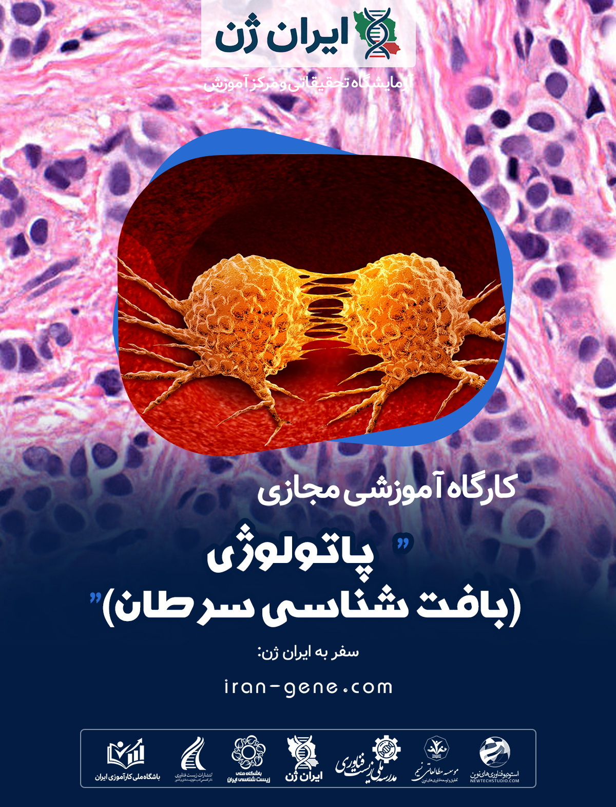 کارگاه آموزشی پاتولوژی (بافت شناسی سرطان)
